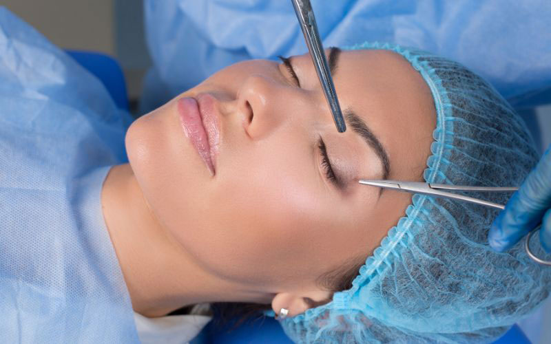 Blefaroplastia: Tudo o que você precisa saber antes de realizar a cirurgia de pálpebras.